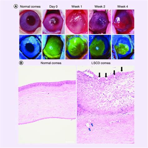 Establishment Of Limbal Stem Cell Deficiency Model After The Ocular