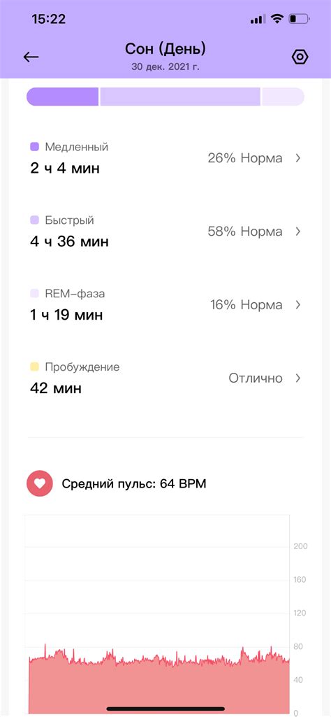 Обзор умных часов Redmi Watch 2 Lite дешевле $100