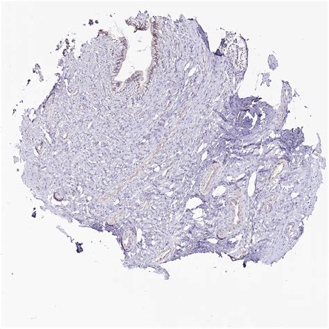 Tissue Expression Of Mmp25 Staining In Cervix The Human Protein Atlas