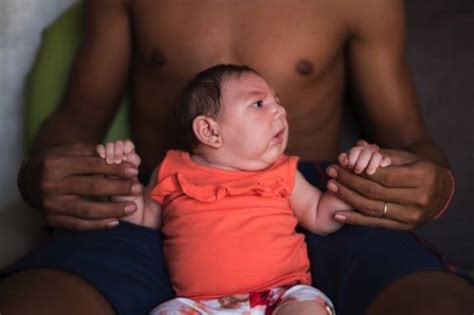 Cdc Issues Travel Warning After First Baby Born In The U S With Zika