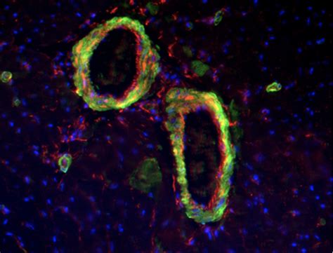 Immunofluorescence Nc Dna Day Blog