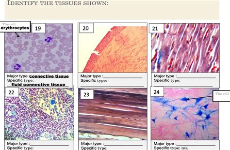 Solved Identify The Tissues Shown The Cell Erythrocytes Chegg