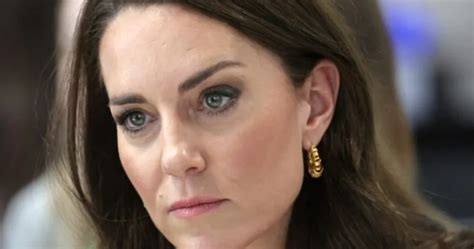 Kate Middleton E Il Tumore Parla Loncologo