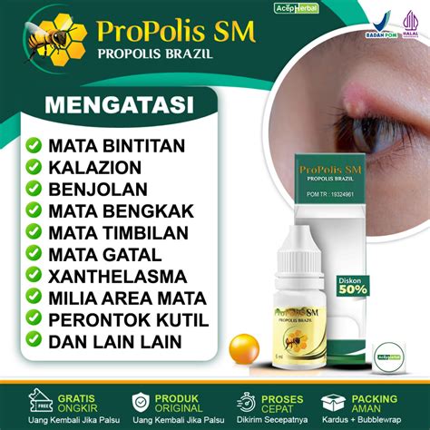 Jual Obat Mata Bintitan Benjolan Bernanah Kalazion Di Kelopak Mata