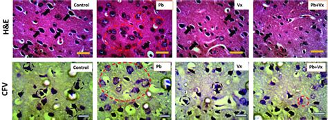 Representative Photomicrograph Of Haematoxylin And Eosin Hande Stain As