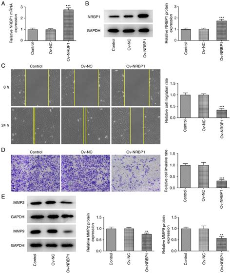 Overexpression Of Nrbp Inhibits The Invasion And Migration Of Bc