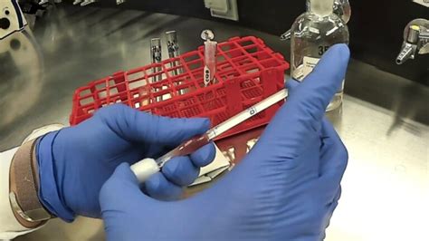 Revolutionary Thoma Pipette A Breakthrough For White Blood Cells