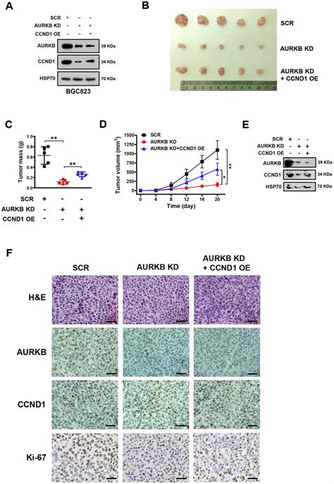 Aurkb Promotes Gastric Cancer Progression Via Activation Of Ccnd