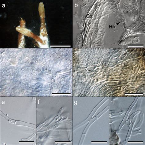 Morpho Anatomical Characteristics Of Mycorrhizae Of Hydnum Albidum Like