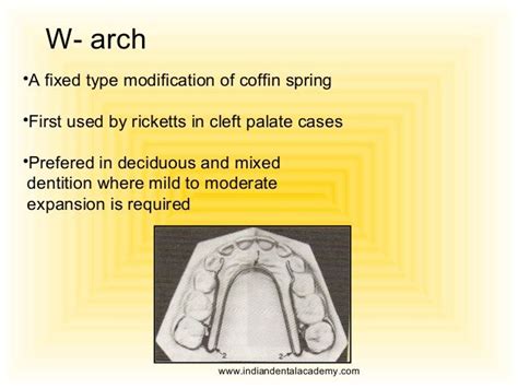 W Arch •a Fixed Type Modification Of Coffin Spring •first Used By