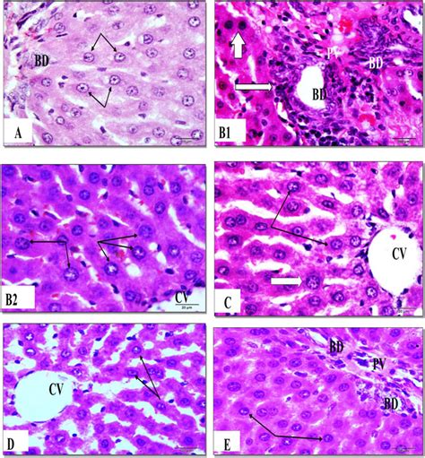 Photomicrographs Of Liver Sections Stained With H E Of The Different