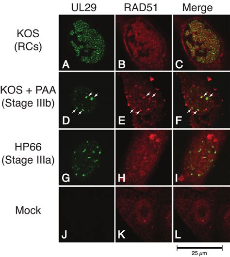 RAD51 Colocalizes Predominantly With UL29 In Replication Compartments