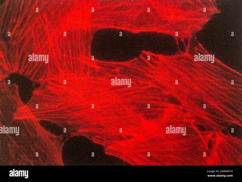 Fluoresence Microscopy Of Cells Specifically Fibroblasts Stained With