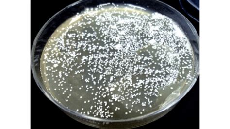 Actinomycete Growth On Starch Casein Agar Plate Showing Regular Rounded