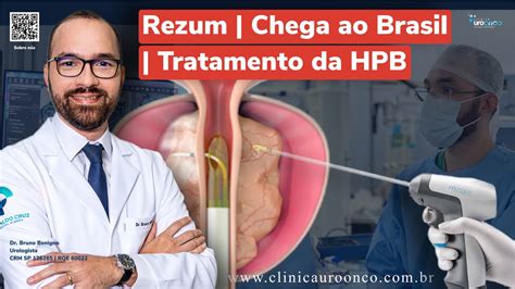 Chega ao Brasil o REZUM Nova opção de tratamento da Hiperplasia