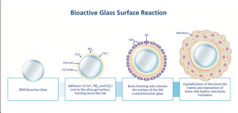 What Is Bioactive Glass Medivizor