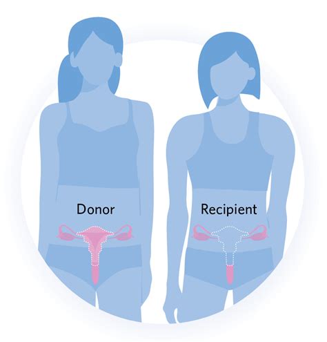 Infographic Research Questions To Be Tackled By Uterus Transplants The Scientist Magazine®