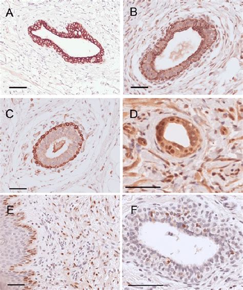 Immunolocalization Of Markers Of Epithelial Differentiation A