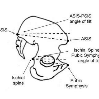 Pelvic Anatomy Asis - Human Anatomy