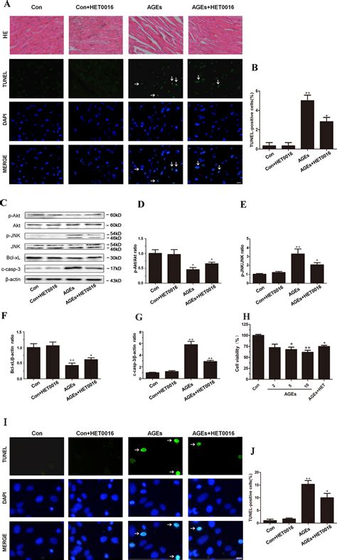 Frontiers Specific Inhibition Of CYP4A Alleviates Myocardial