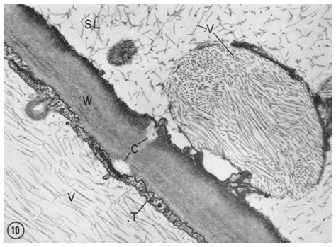 Figure L0 Nicotiana Tabacum Section Of Mature Sieve Element Right