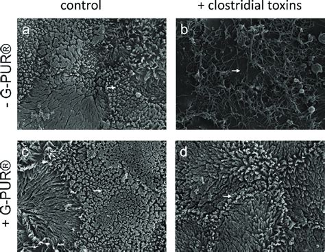 Scanning Electron Microscopy Of The Apical Surface Of Caco Cell