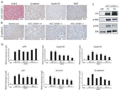 Molecular Features Of Liver Tumors Induced By Hmet N Catenin