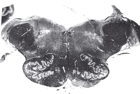 Rostral Medulla Slice Diagram Quizlet