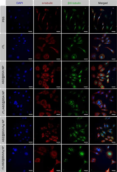 Confocal Images Of Cells Labeled Tubulin Antibody Red Iii Tubulin