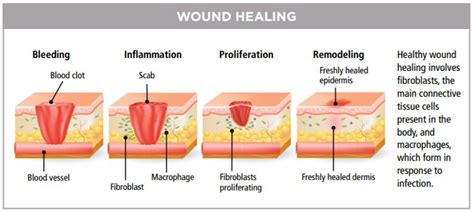 diagram of wound healing stages | Penyembuhan, Motivasi belajar, Belajar