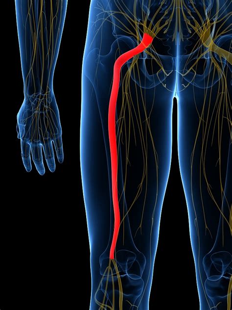 Sciatic Nerve Pain: Causes, Symptoms, and Treatment Options