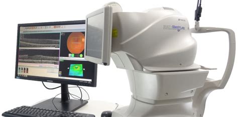 What Is An Oct Eye Scan Dr Bruce Coward And Associates