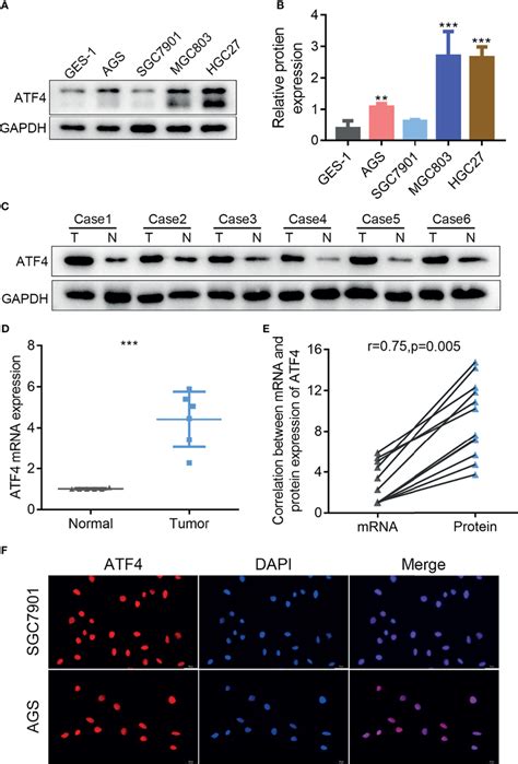 The Expression Of Activating Transcription Factor 4 ATF4 Is