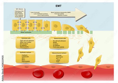 Epithelialmesenchymal Transition EMT Losing Cell Polarity And Cell