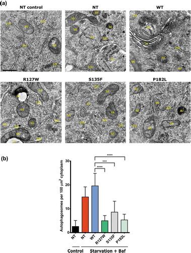 Full Article Neuropathy Causing Mutations In Hspb Impair Autophagy By