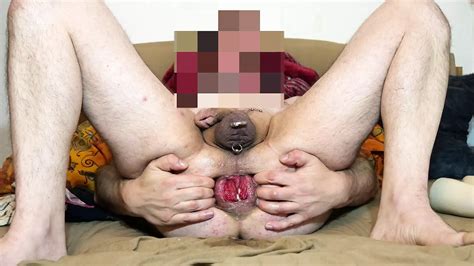 Gummi Fisting Free Gay Small Cock HD Porn Video XHamster