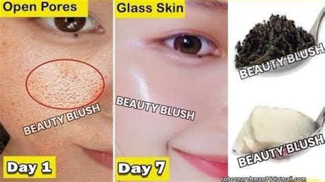 How To Get Rid Of Large Open Pores Permanently In Days Youtube