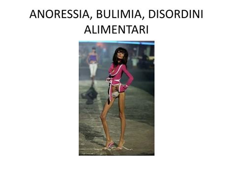 Ppt Anoressia Bulimia Disordini Alimentari Powerpoint Presentation