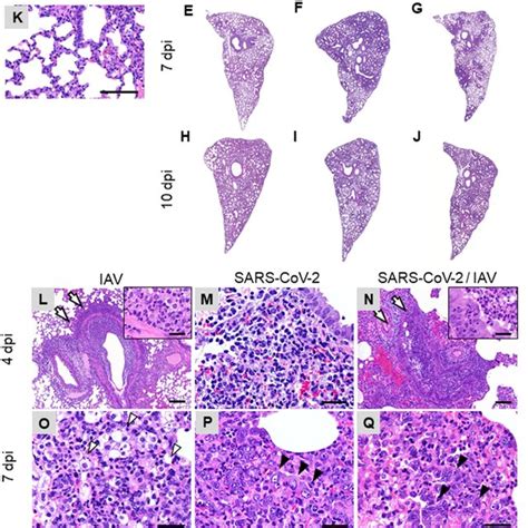 Histopathological Analysis Of Lungs Of Infected Hamsters Lung Sections