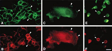 Double Label Immunofluorescence Microscopy Shows That Ccr5 A C And