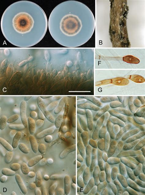 Colletotrichum Salsolae A CH ICMP 19051 Ex Holotype Culture B