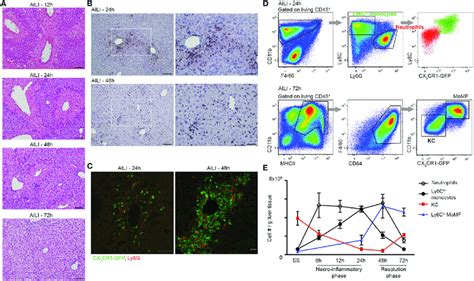 | liver infiltrating ly6c hi monocytes, monocyte-derived macrophage ...