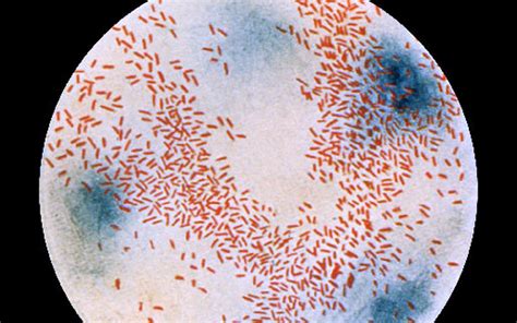 Haemophilus Influenzae Photos Cdc