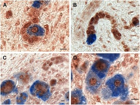 A Newly Differentiated Hepatocyte Blue Within A Strongly Forkhead