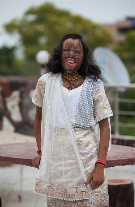 Indian Acid Attack Victims Pose For Fashion Shoot