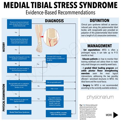 Physionarium - 📄 MEDIAL TIBIAL STRESS SYNDROME (MTSS