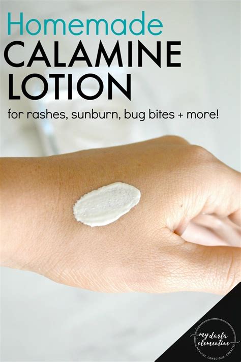 Homemade Calamine Lotion For Rashes Sunburn Bug Bites And More Lotion Anti Itch Cream