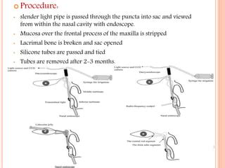 Dacryocystorhinostomy Ppt