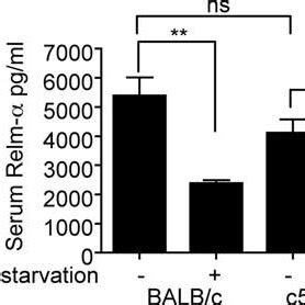 Serum Expression Of Relm The Expression Of Relm In The Serum Of