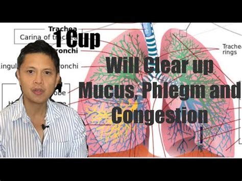 Cup Will Clear Up Mucus Phlegm And Chest Congestion Tanggal Ang